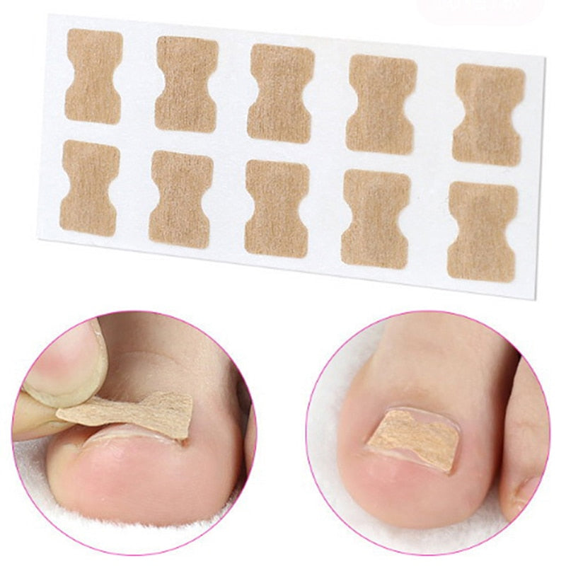 Ingrown Toenail Correction Patch Toenail Brace Pedicure Tool Double-sided Tape Nail Repair/10Pcs