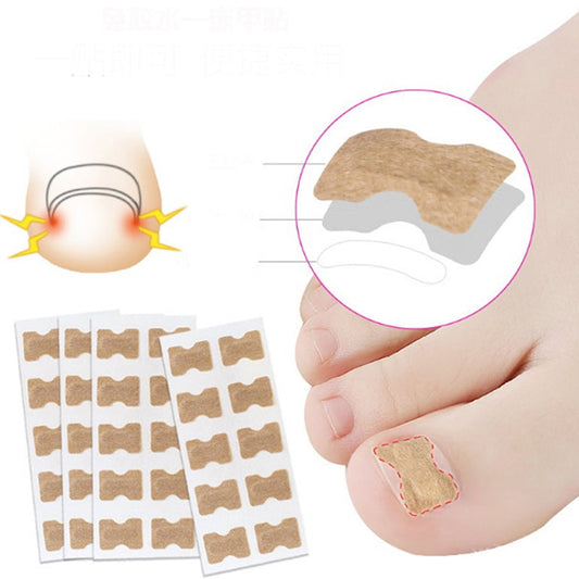 Ingrown Toenail Correction Patch Toenail Brace Pedicure Tool Double-sided Tape Nail Repair/10Pcs